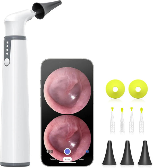 AnyScope, Bezprzewodowy otoskop wyposażony w żyroskop, 3.9 mm